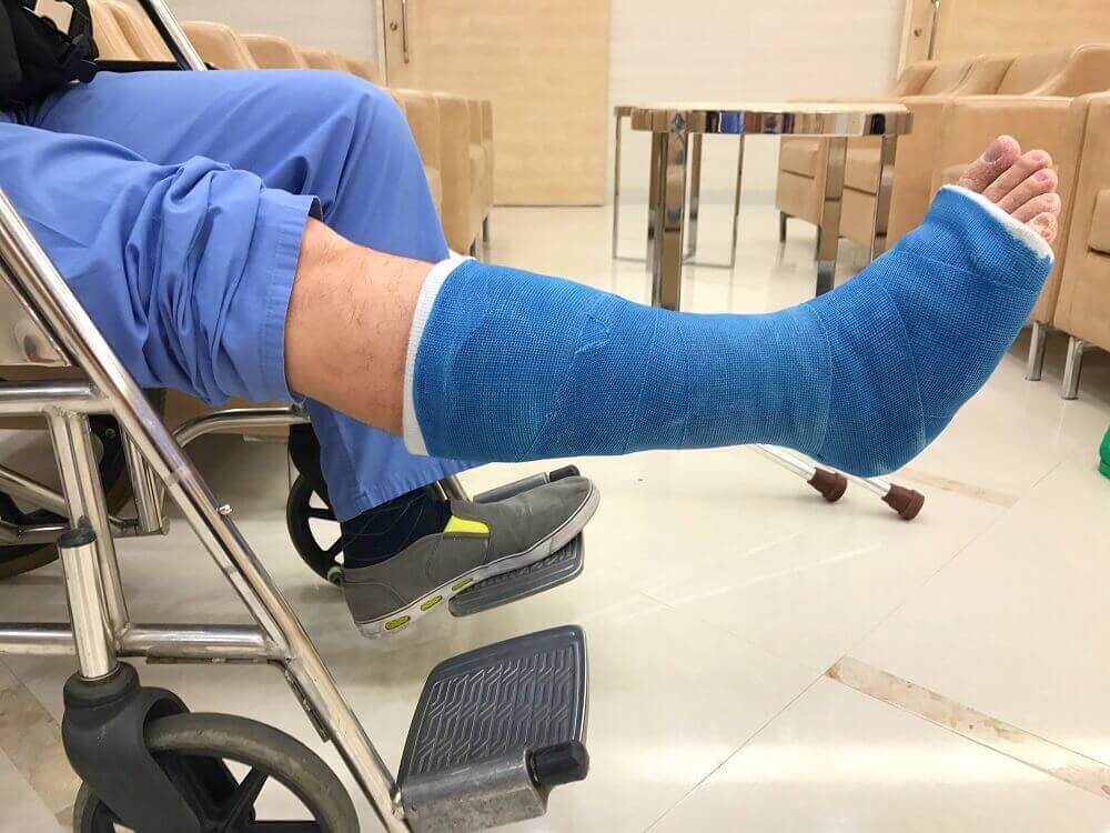 Patient suffering broken leg injury from slip and fall.